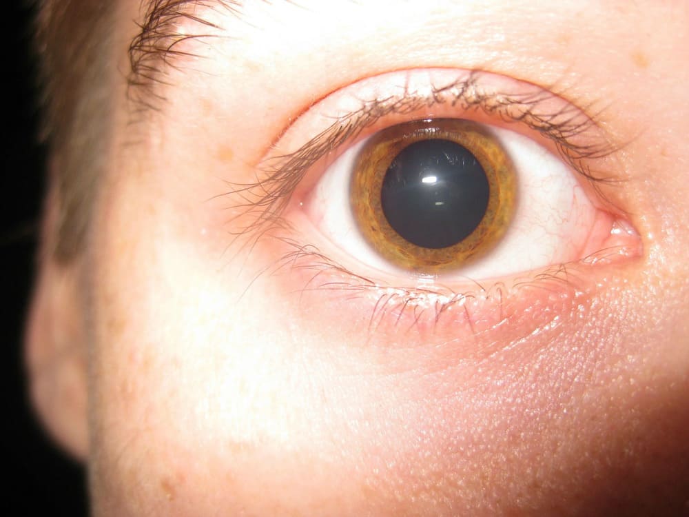 Все про спиды («скорость»)